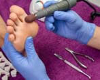 Podologue Curryer Foot Specialists Ottawa